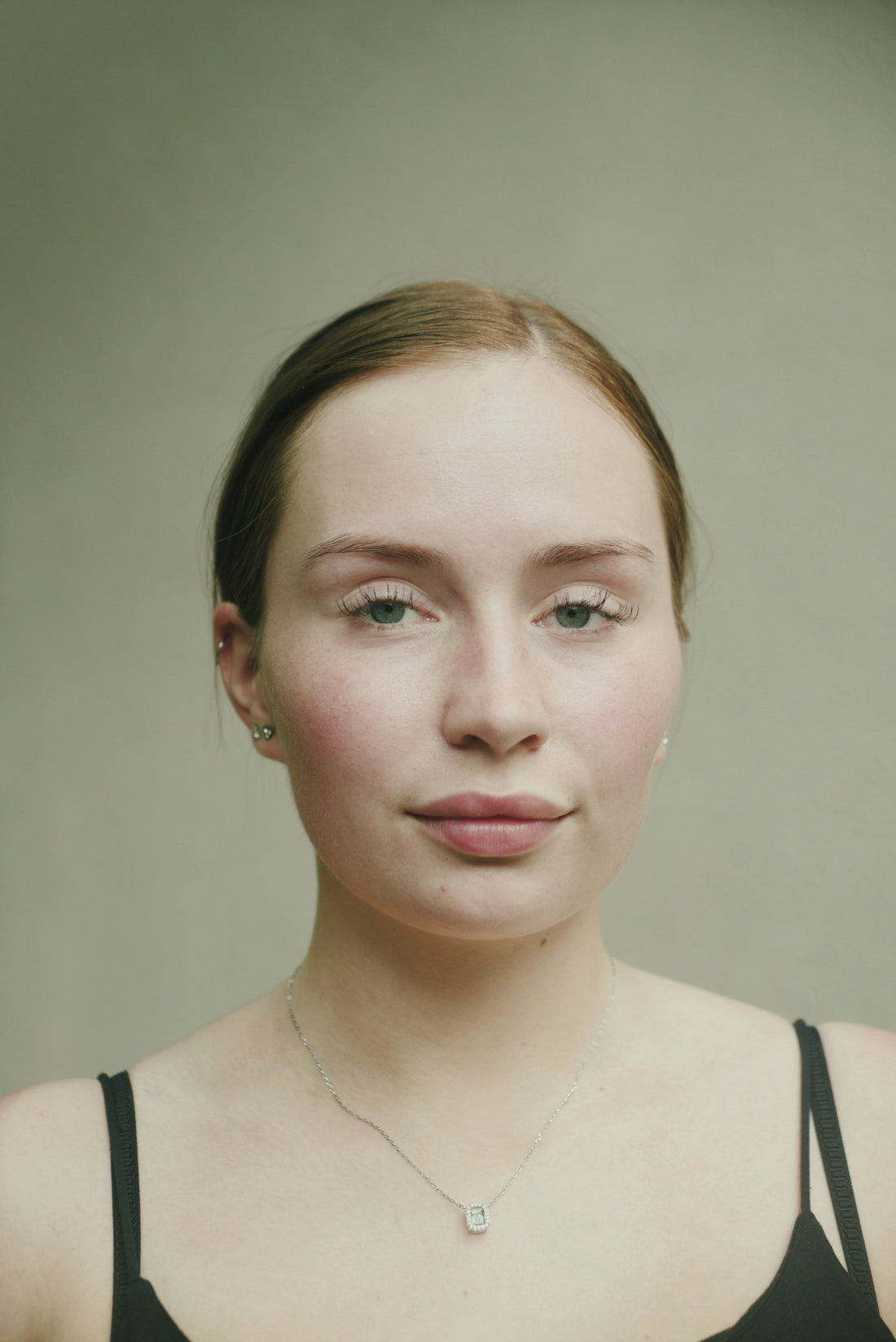 Understanding Your Skin Barrier: How to Protect and Restore It